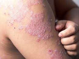 promo-banner-image