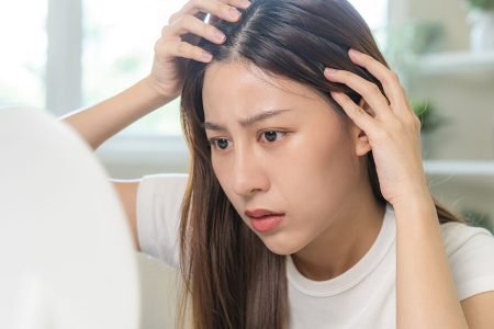 prevent-pcos-hair-loss-1024×585 prevent-pcos-hair-loss-1024x585